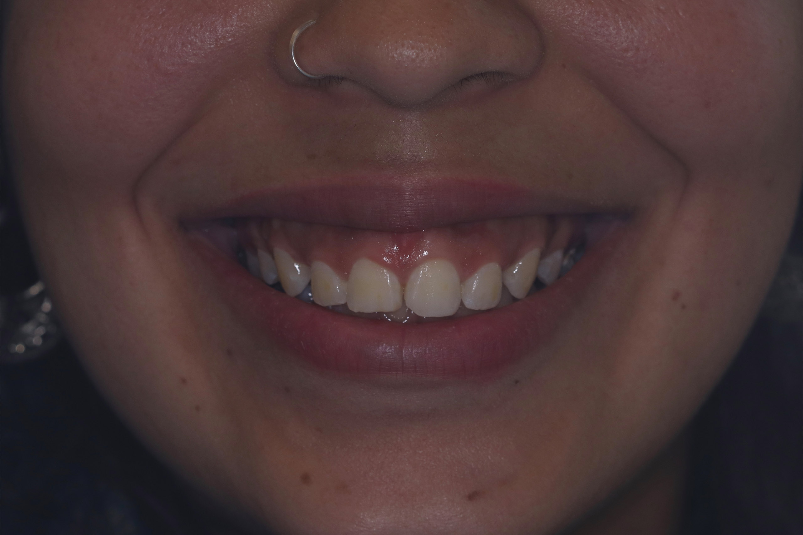 teeth